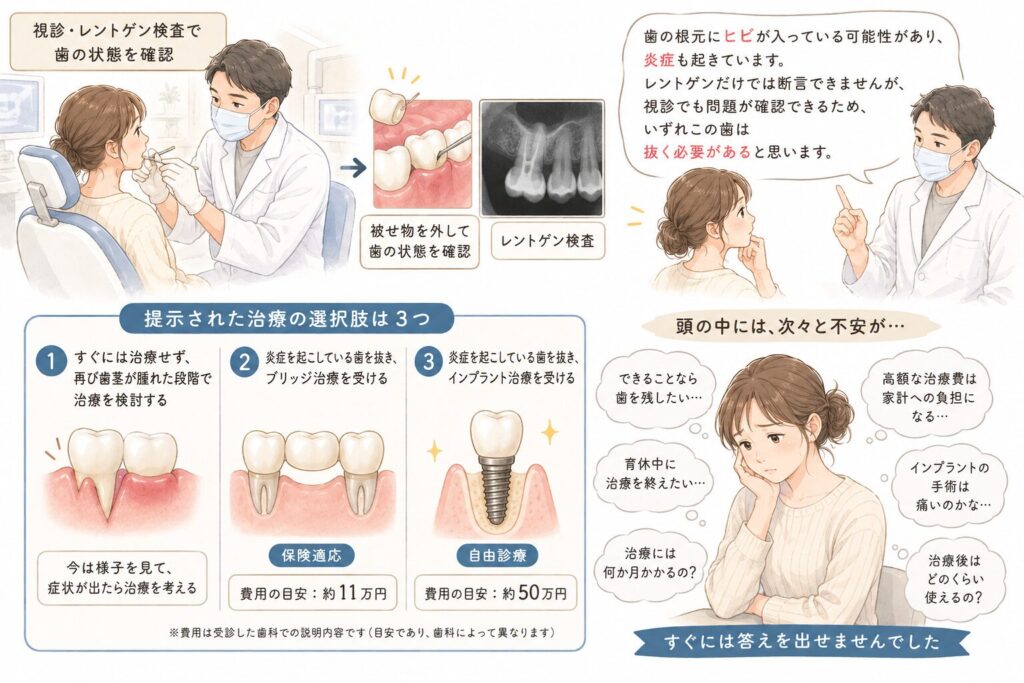 歯科で視診とレントゲン検査を受け、歯の根元のヒビや炎症について説明され、経過観察・ブリッジ・インプラントの3つの治療選択肢と費用、不安な気持ちをまとめたイラスト